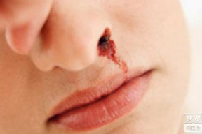 鼻癌的照片,揭示鼻癌的视觉特征与诊断要点