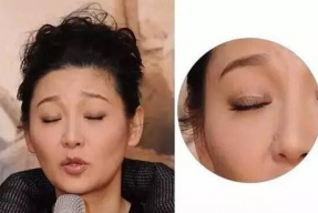 双眼皮 贴 明星,揭秘双眼皮的秘密武器